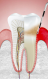 Periodontia